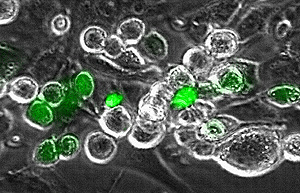 cells courtesy of Schreiber-Argus lab