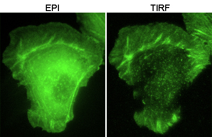 F-actin-TIRF-vs-EPI-FIG.jpg (67136 bytes)
