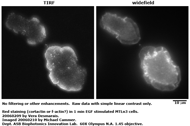 TIRF-vs-widefield-fig.gif (84035 bytes)